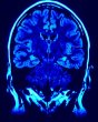 Brain